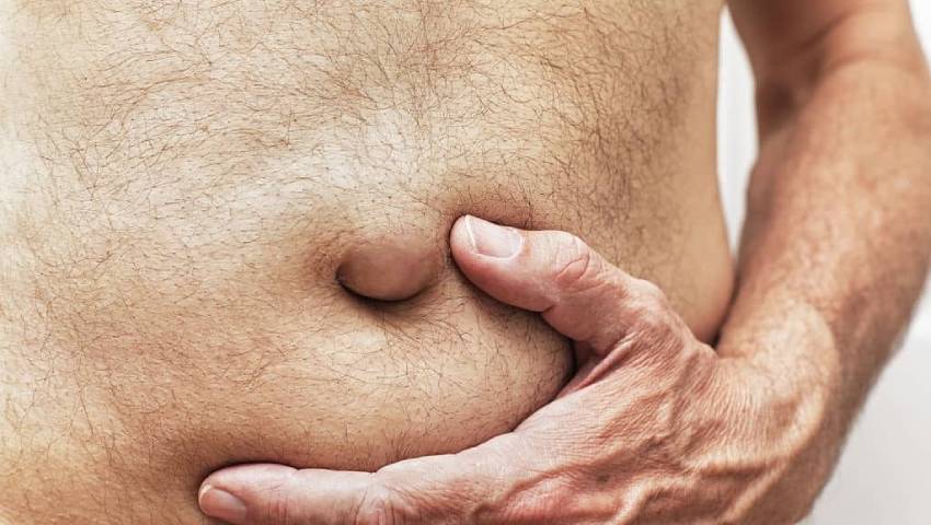Hernia